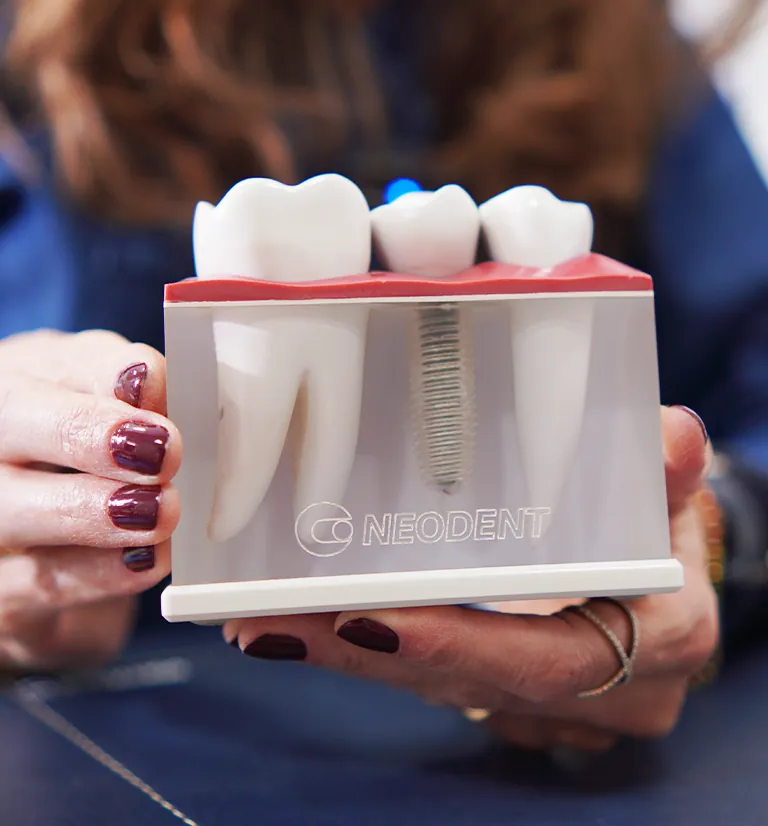 Ilustração do tratamento: Implante dentário