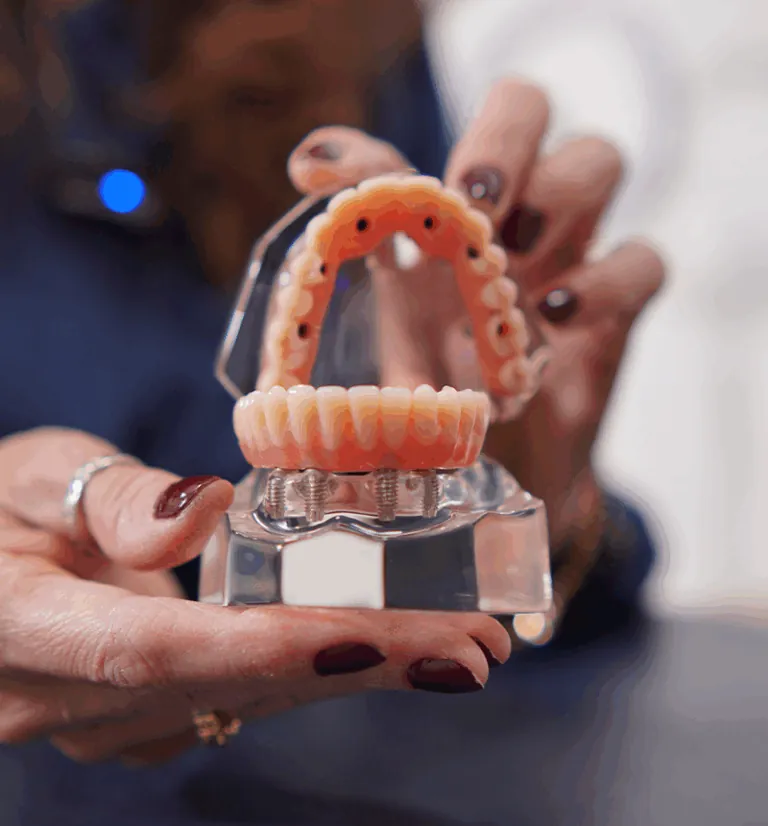 Ilustração do tratamento: Prótese dentária